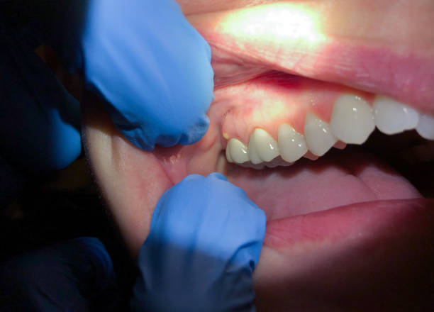 Best Pediatric Emergency Dentist in Kincaid, IL